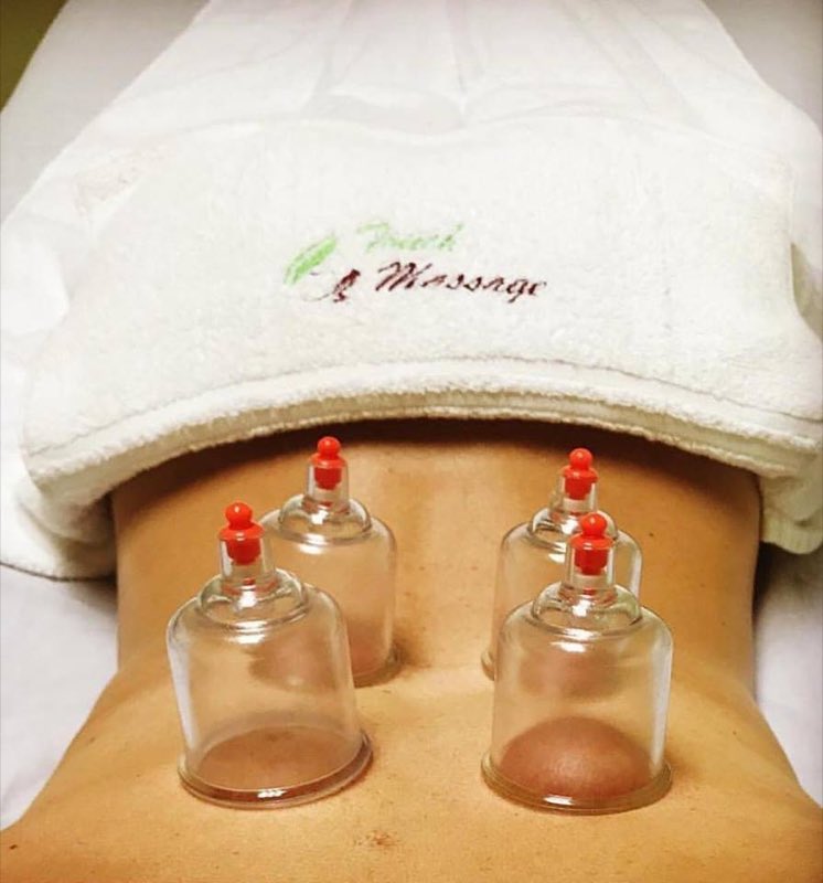 Cupping therapy session on a client's back